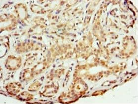 FKBP25 / FKBP3 Antibody (aa2-224)