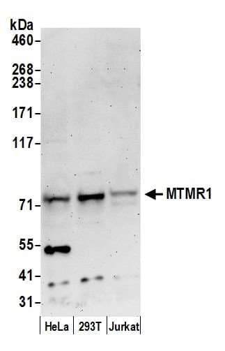 MTMR1 Antibody (aa615-665)