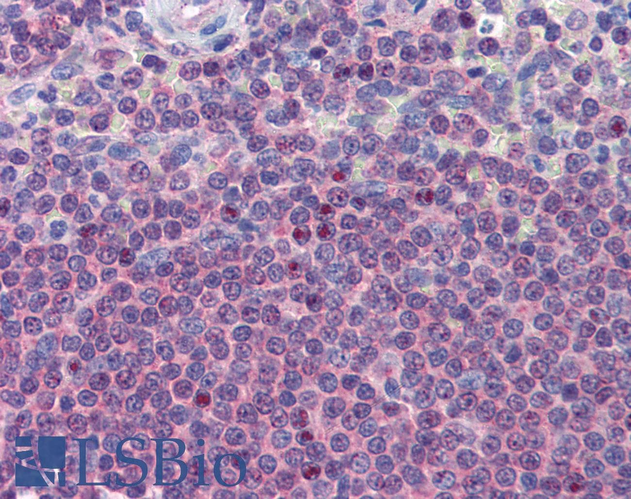 IHC-plus™ AKIRIN2 Antibody