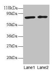 IHC-plus™ BLOC1S1 Antibody