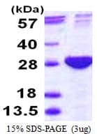 Human PSMB4 Protein (Recombinant His)