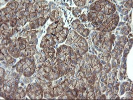 PHF7 Antibody (aa155-381, clone OTI1A2)
