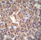 Polyclonal Rabbit anti-Human CTU1 Antibody (aa208-236, IHC, WB)