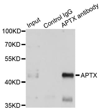 Polyclonal Rabbit anti-Human Aprataxin / APTX Antibody (IHC, IF, WB)