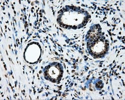 LOX / Lysyl Oxidase Antibody (clone OTI9G6)