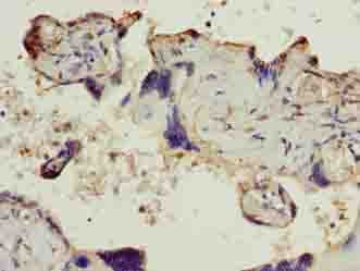Polyclonal Rabbit anti-Human SLC6A6 / Taurine Transporter Antibody (IHC, WB)