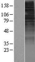 OR10H2 Protein (Over-Expression Lysate Myc-DDK (Flag))
