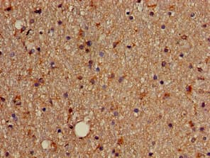 Polyclonal Rabbit anti-Human SOX4 Antibody (aa1-60, IHC, WB)