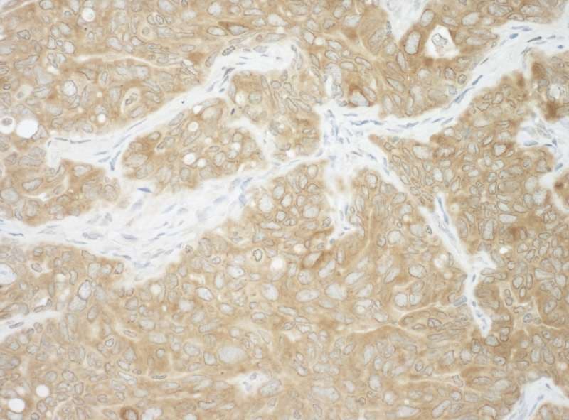 AUP1 Antibody (aa426-476)