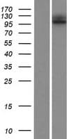 ESPNL Protein (Over-Expression Lysate Myc-DDK (Flag))