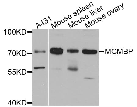 MCMBP / C10orf119 Antibody