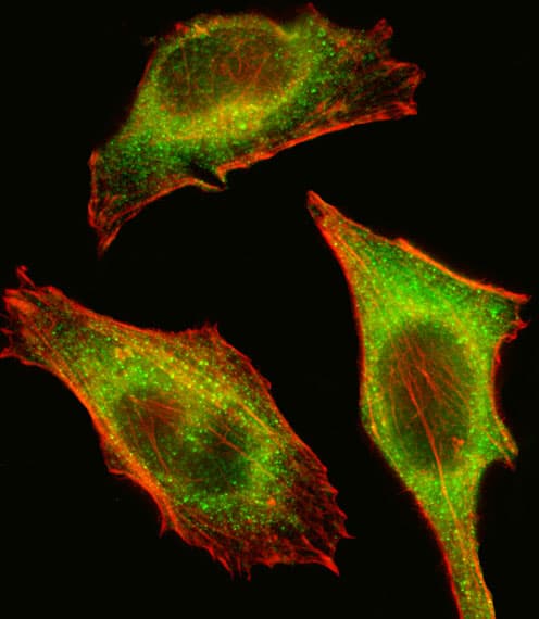 TEC Antibody (aa175-205)