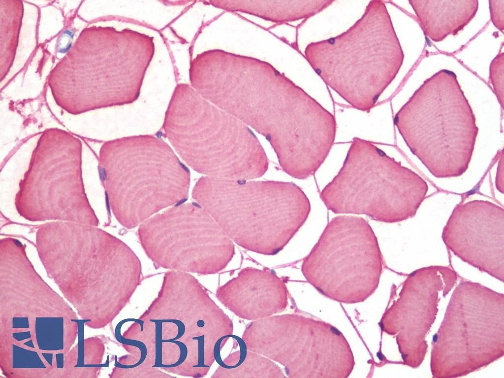 IHC-plus™ Monoclonal Rabbit anti-Human MB / Myoglobin Antibody (clone EPR2581Y, C-Terminus, IHC, WB)