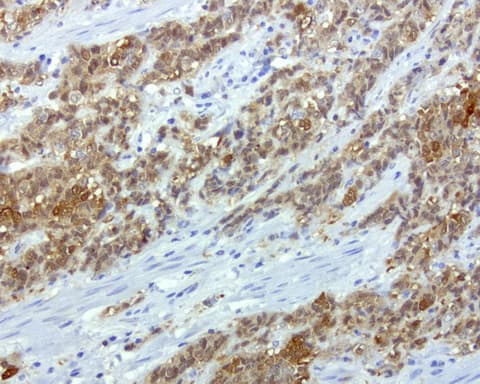 CRABP2 Antibody (clone UMAB176)