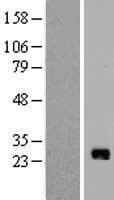 IL17B Protein (Over-Expression Lysate Myc-DDK (Flag))