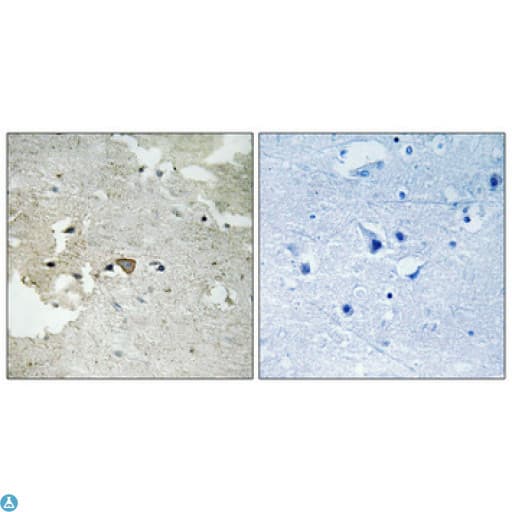 AXL Antibody