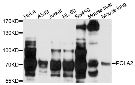 POLA2 / DNA Polymerase Alpha 2 Antibody