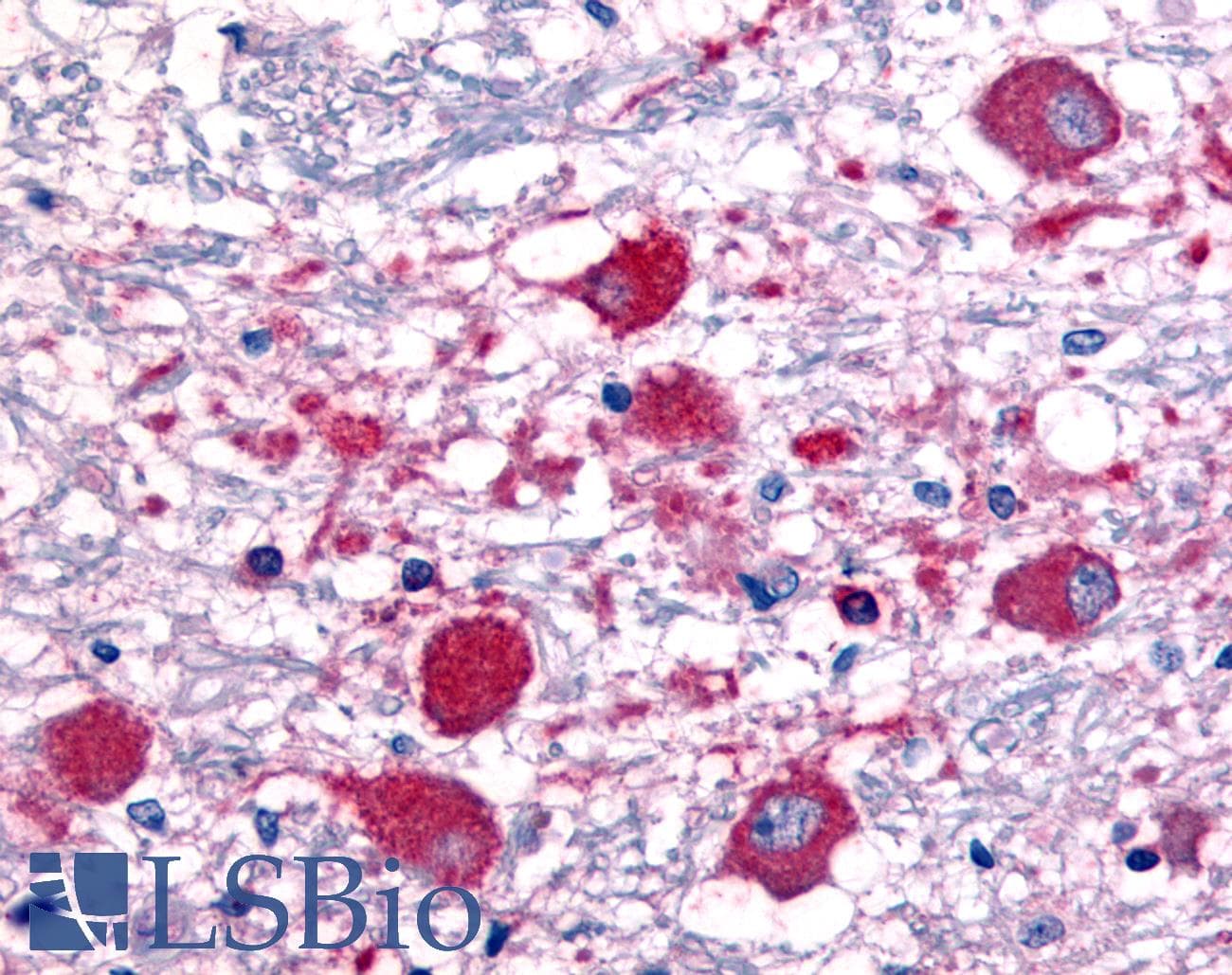 IHC-plus™ ROBO1 Antibody (aa1625-1650)