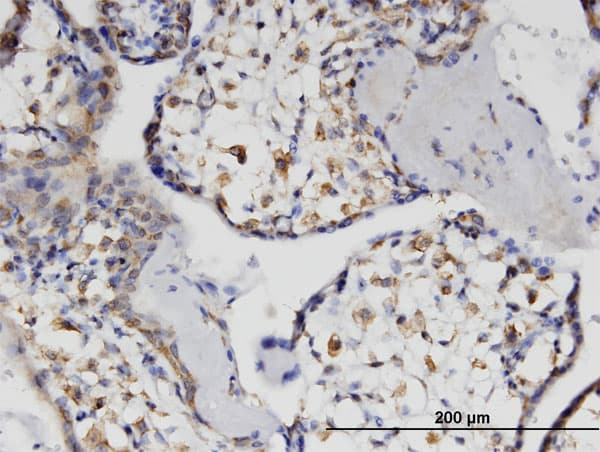 Monoclonal Mouse anti-Human ALX / HSH2D Antibody (clone 1D6, IHC, WB)