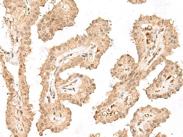 CCDC132 Antibody