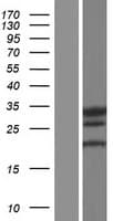 LHPP Protein (Over-Expression Lysate Myc-DDK (Flag))