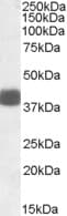 FBXO32 / Fbx32 Antibody (aa70-82)