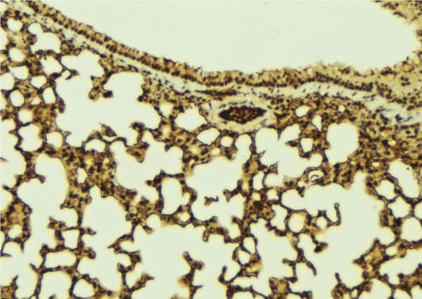 LRPPRC Antibody