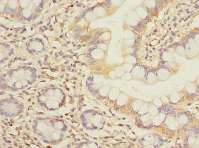 Carom / FCHSD2 Antibody