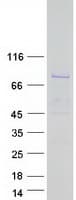 Human DQX1 Protein (Recombinant Myc-DDK (Flag))