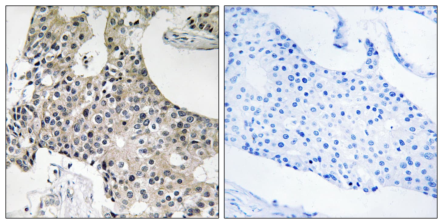 Polyclonal Rabbit anti-Human TECR / TER Antibody (aa259-308, IHC)