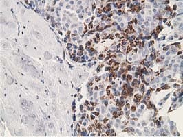 Monoclonal Mouse anti-Human SSX1 Antibody (clone OTI2F8, IHC, IF, WB)