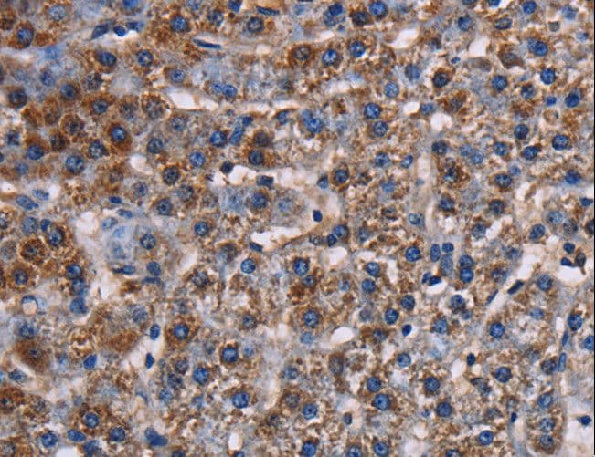 TWIK1 / KCNK1 Antibody