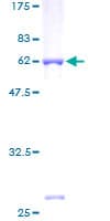 Human AKR1B10 Protein (Recombinant GST)