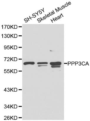 Polyclonal Rabbit anti-Human PPP3CA / CCN1 / Calcineurin A Antibody (IHC, WB)