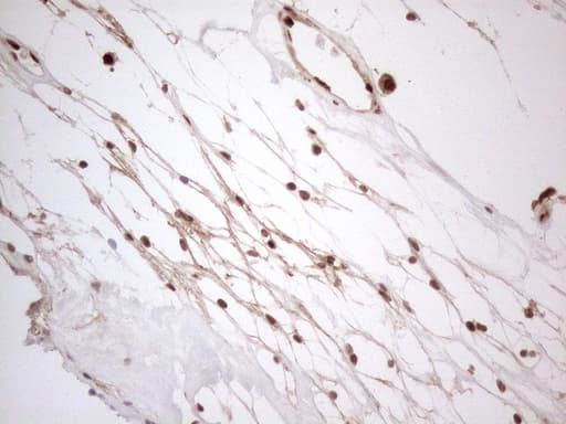 IRS1 Antibody (aa1-280, clone OTI3G10)