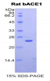 Rat BACE1 / BACE Protein (Recombinant His)