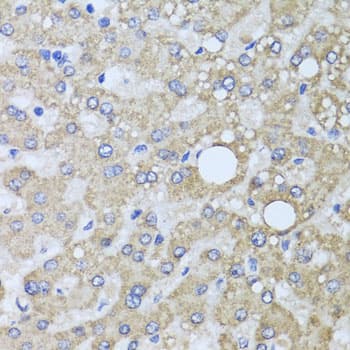 Polyclonal Rabbit anti-Human AARS2 Antibody (IHC, WB)