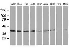 DNAJB1 / Hsp40 Antibody (clone OTI1G4)