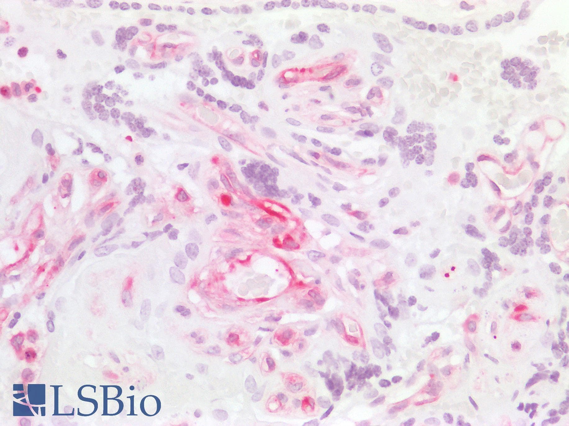 PathPlus™ Monoclonal Mouse anti-Human MSN / Moesin Antibody (clone 2C12, aa292-491, IHC, WB)