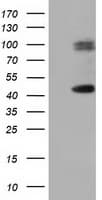 HP / Haptoglobin Antibody (clone OTI1F9)