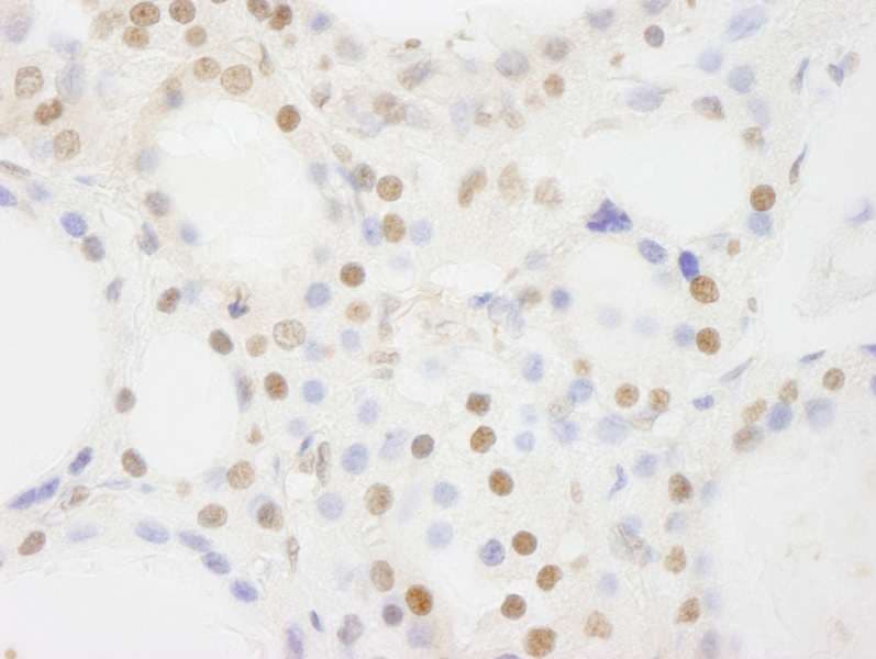 Polyclonal Rabbit anti-Human BRF1 Antibody (aa627-677, IHC)