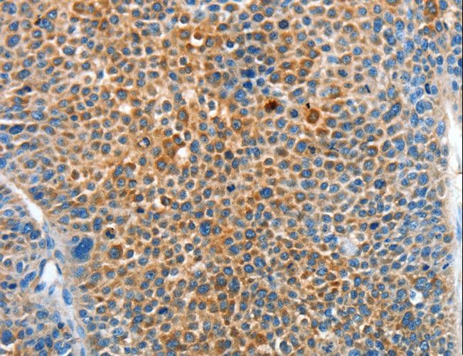 SERPINF2 / Alpha-2-Antiplasmin Antibody