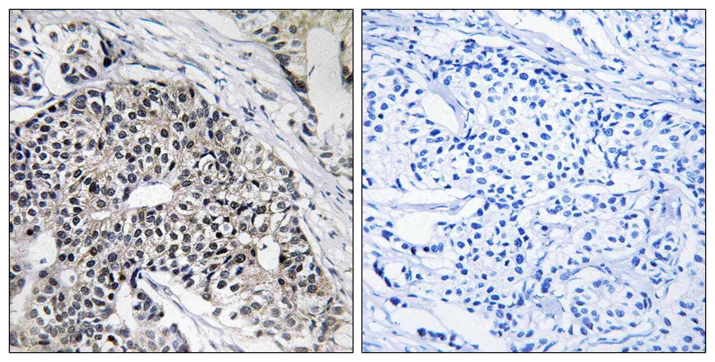 MRPL24 Antibody