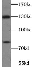 AMOT / Angiomotin Antibody