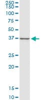 CTGF Antibody (clone 2C11)