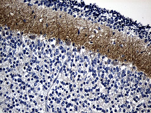 GRM4 / MGLUR4 Antibody (aa126-407, clone OTI6D1, Carrier-free)