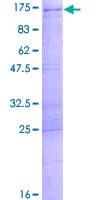 Human SART1 Protein (Recombinant GST)