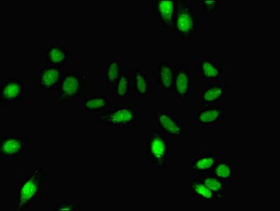 DNM1 / Dynamin Antibody (aa2-245)
