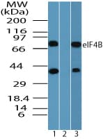 IHC-plus™ EIF4B Antibody (aa150-200)