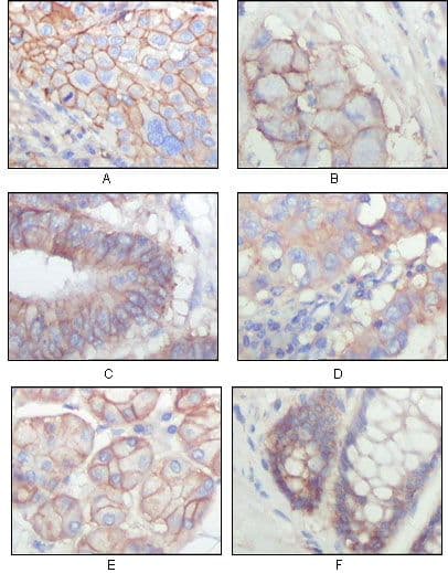 Monoclonal Mouse anti-Human EPHB3 / EPH Receptor B3 Antibody (clone 4A122D1, Amino Acid: 39-212, IHC, WB)